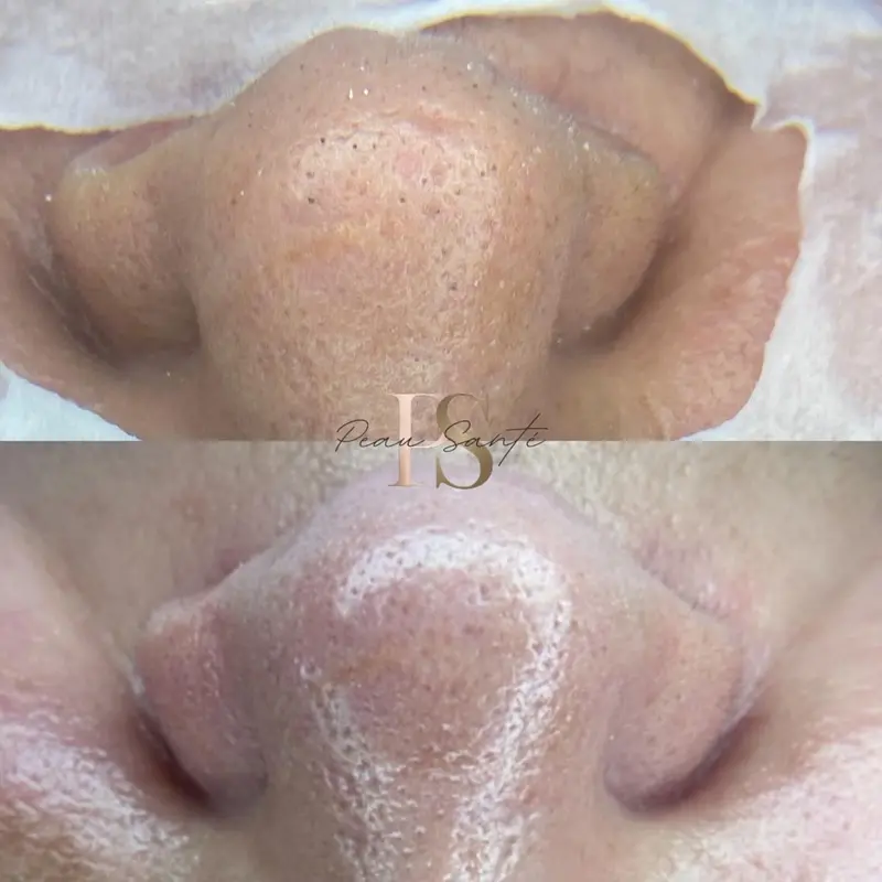 Antes e Depois - Luminosidade e Textura